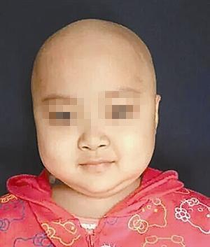 患癌女童罗一笑事件被指“营销炒作” 官方介入