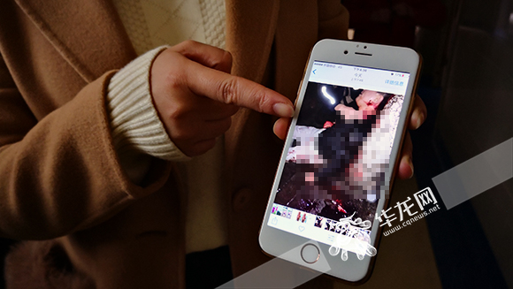 28岁小伙遭异物割破颈静脉 医生将其从死亡线上拉回